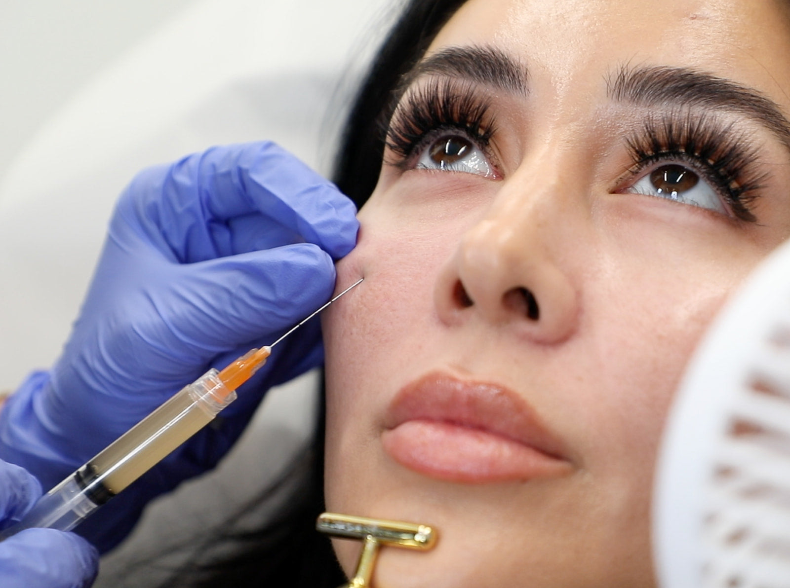 Does Sleeping on One Side Cause Facial Asymmetry? How Fillers Can Help