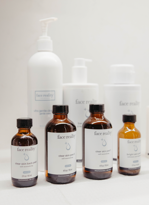 Do Chemical Peels Help With Acne Scars?