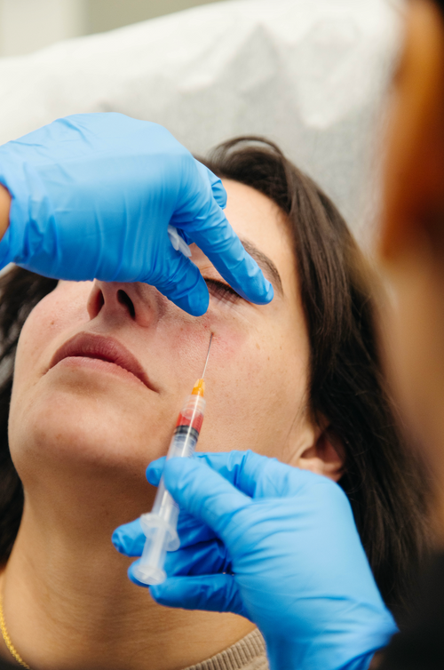 What Is the Best Treatment for Under-Eye Wrinkles?