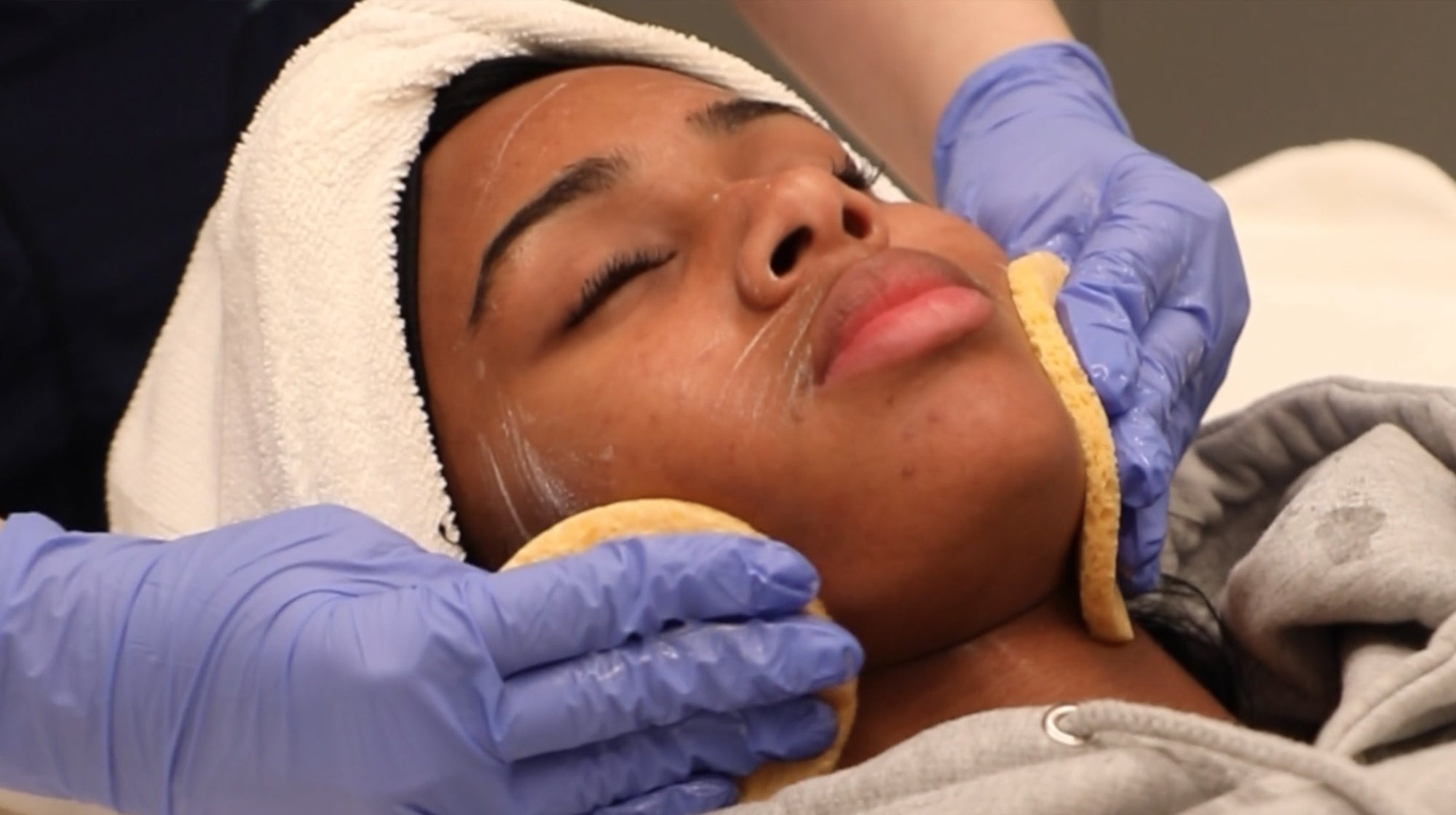 provider rubbing patient's face with pads