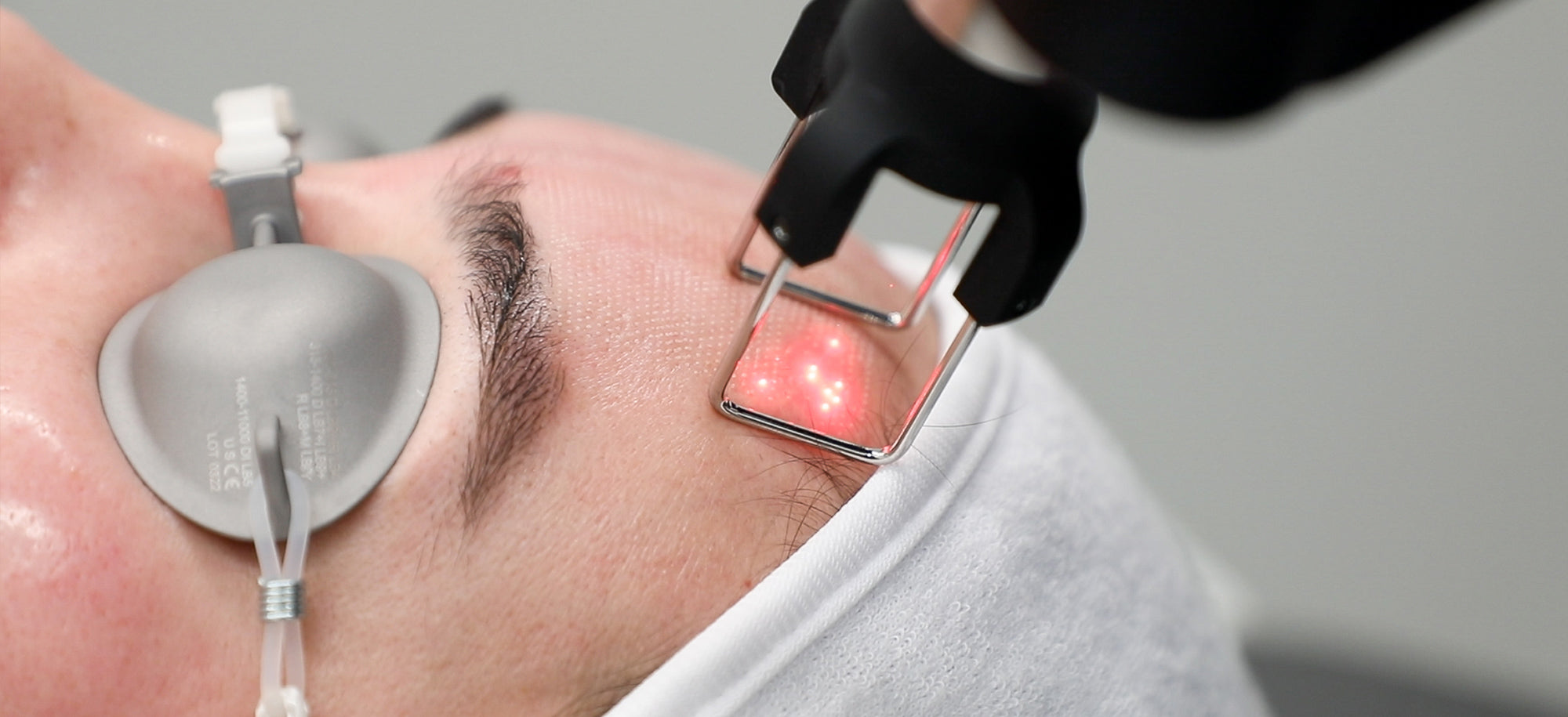 laser treatment tool on forehead