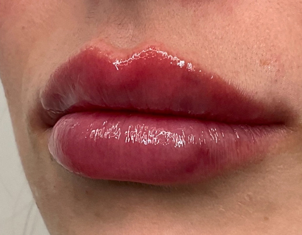 NMA Lips