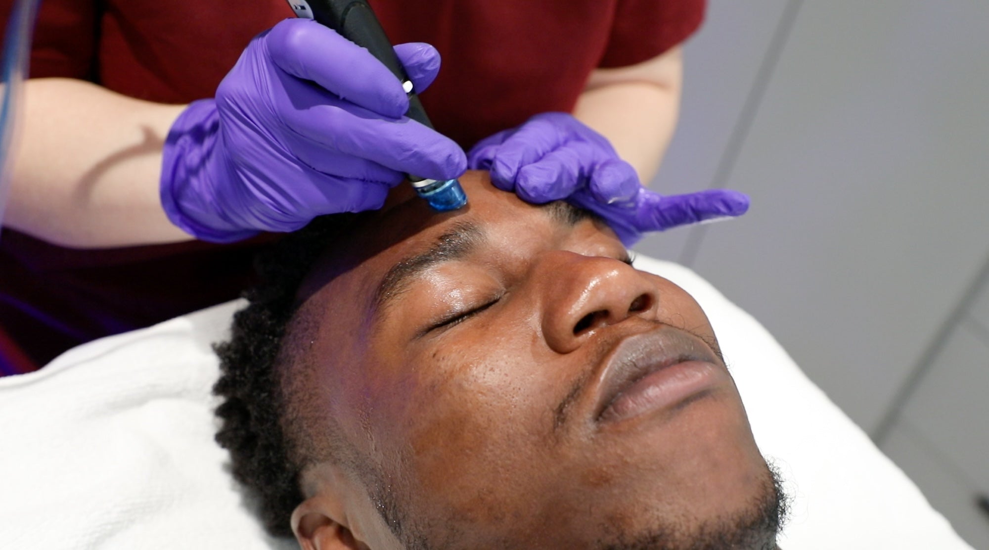 man receiving hydrafacial on forehead