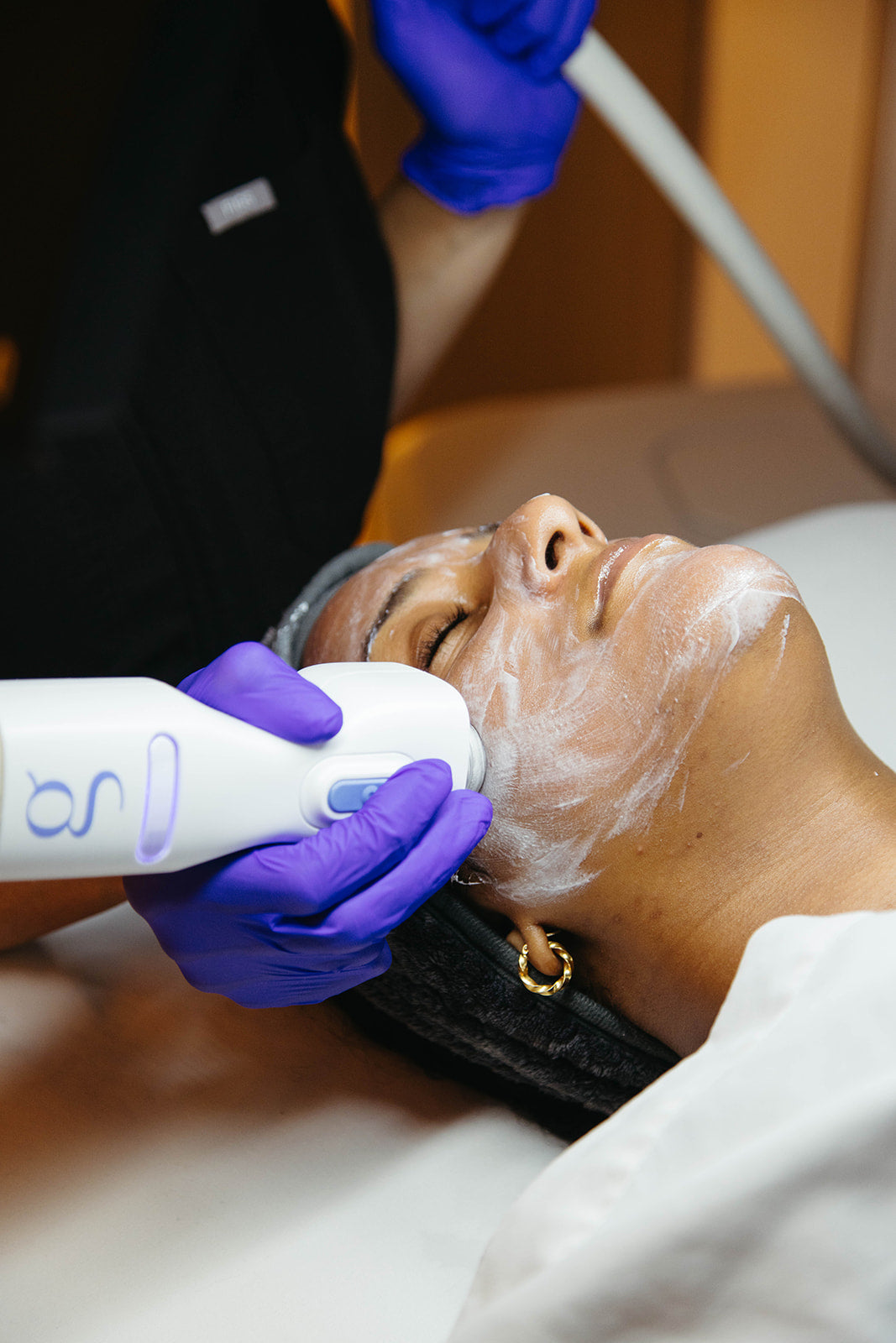 How You Can Get Rid of Sun Spots on Face