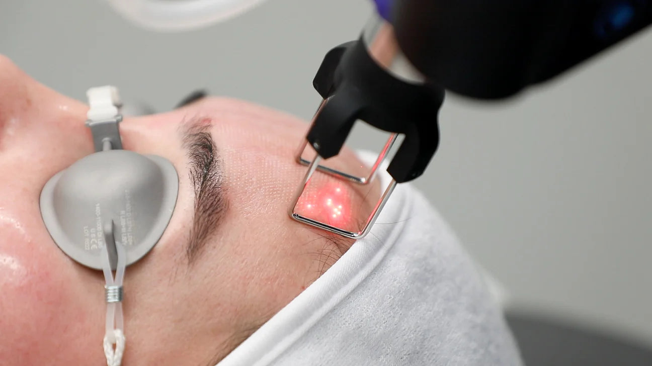 PICO Laser Treatment for Acne Scarring in Arlington, VA: Your Comprehensive Guide to Smooth, Glowing Skin