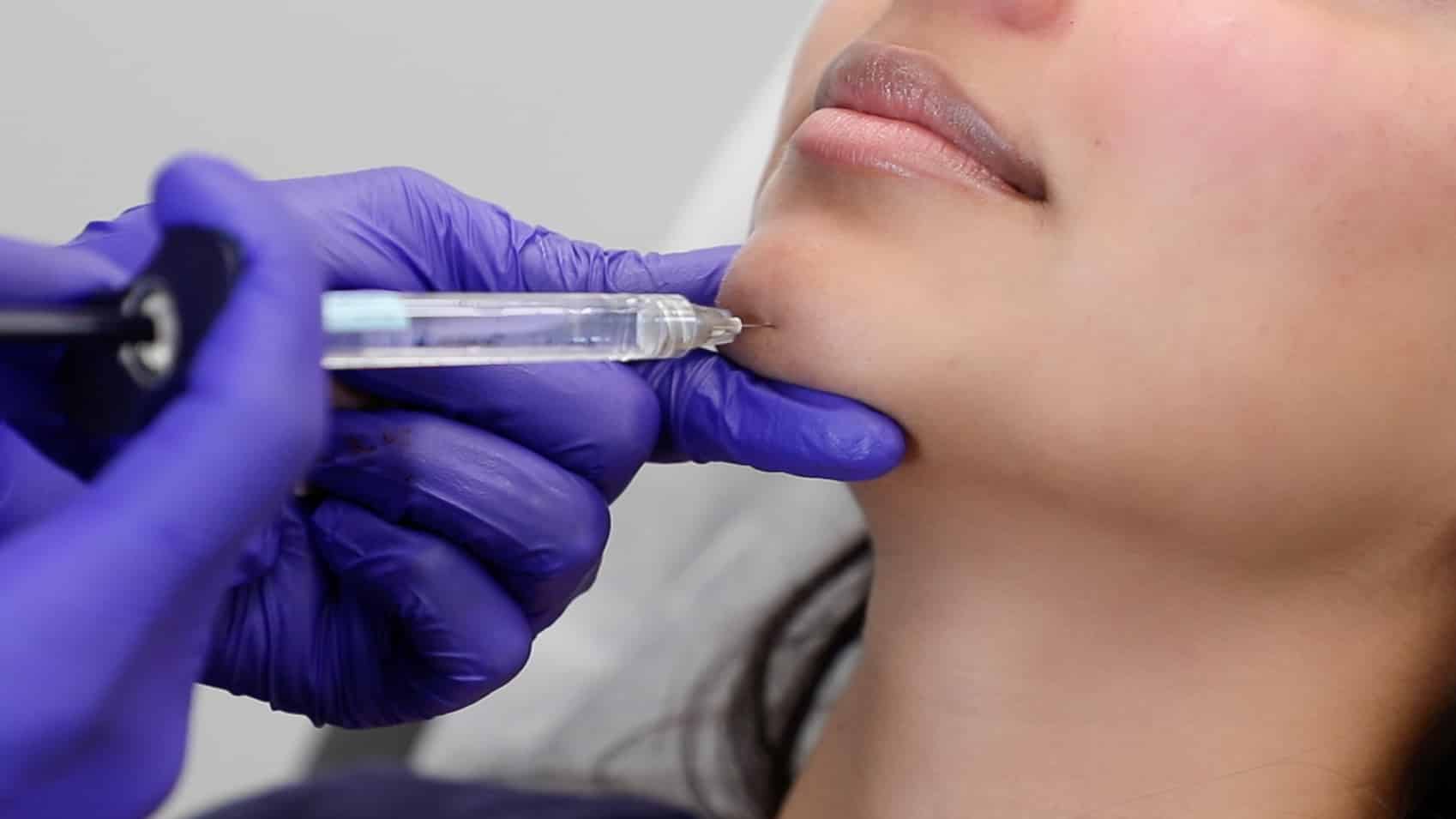WUSA9: The Cosmetic Filler Boom: The Side Effects