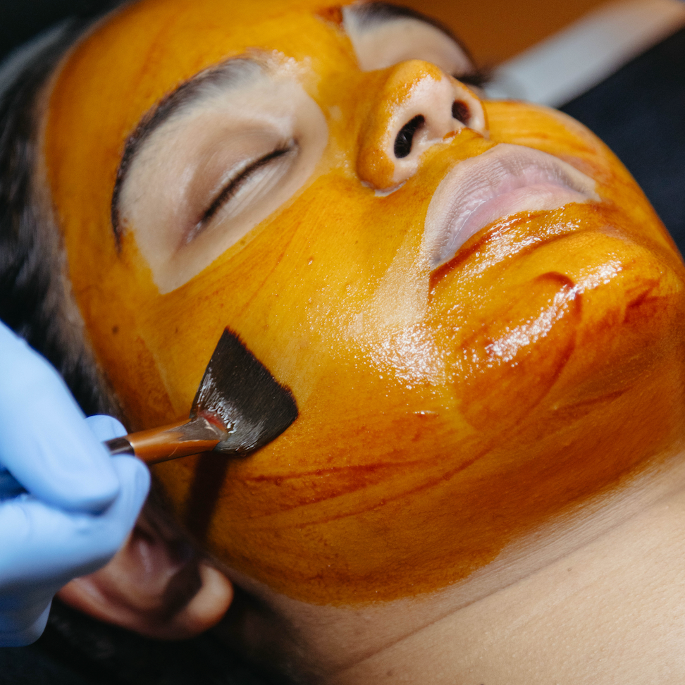 How Does a Chemical Peel Work?
