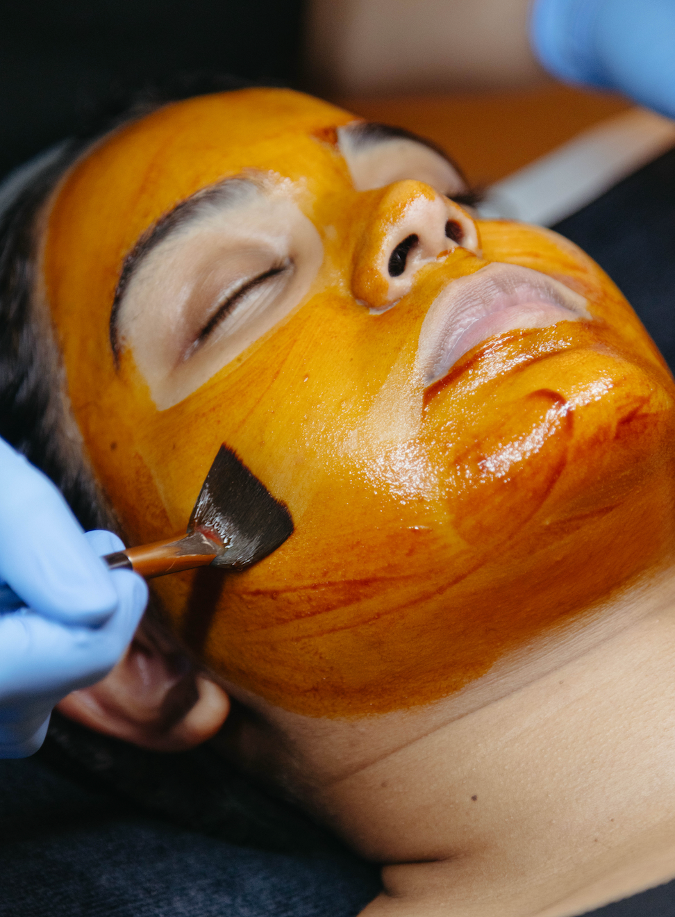 How Does a Chemical Peel Work?