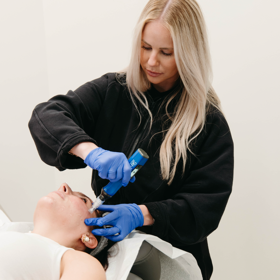 Microneedling vs Laser for Wrinkles: Which Is Better?