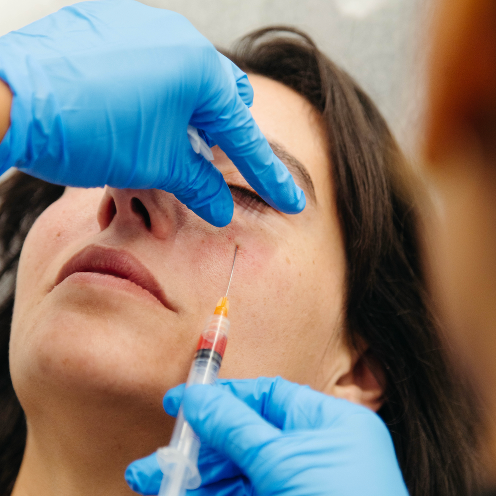 What Is the Best Treatment for Under-Eye Wrinkles?