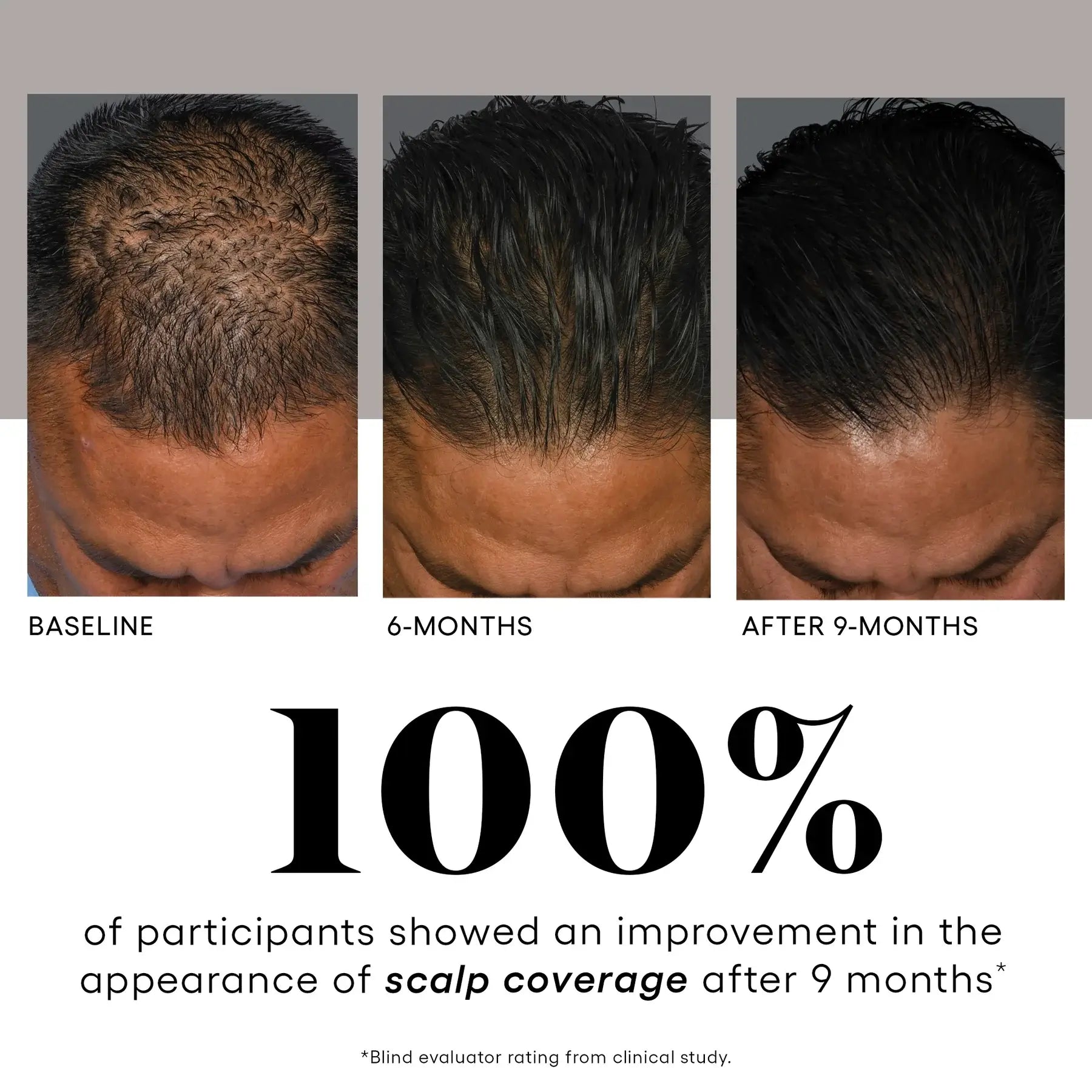 Plated HAIR Serum, before and after hair density