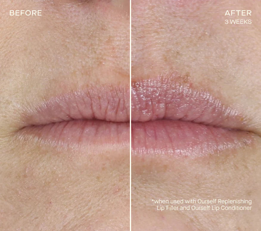 Before & After Ourself Replenishing Lip Filler 