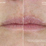 Before & After Ourself Replenishing Lip Filler Refill