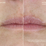 Before & After Ourself Replenishing Lip Filler Refill