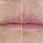Before and After of Lip Plumping Enhancing Regimen