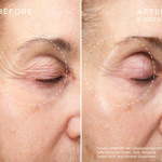 VOLUME RECOVERY SET Before and After