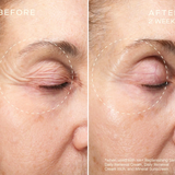 VOLUME RECOVERY SET Before and After