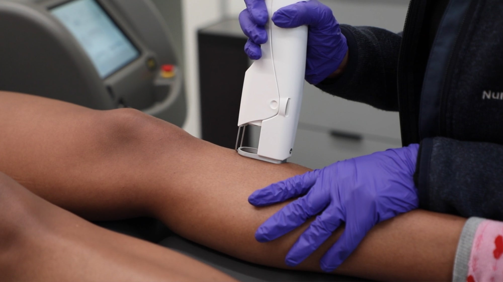 provider holding patient leg laser hair removal