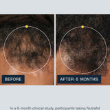 Nutrafol Men clinical study before and after 6 months