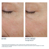 skinbetter science Trio Rebalancing Moisture Treatment, before and after results