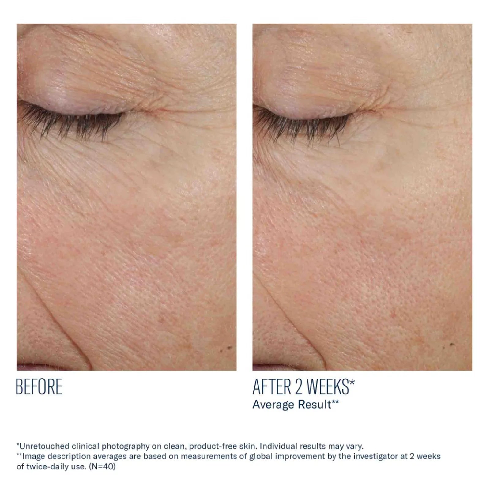 skinbetter science Trio Rebalancing Moisture Treatment, before and after results