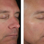 skinbetter science Solo Hydrating Defense Men, results photo