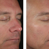 skinbetter science Solo Hydrating Defense Men, results photo