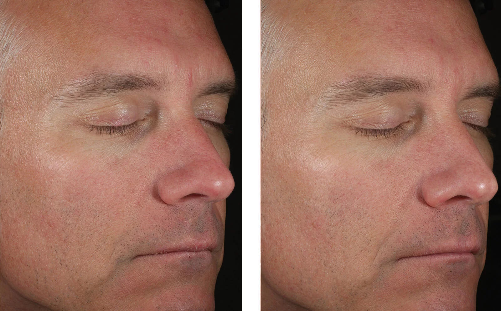 skinbetter science Solo Hydrating Defense Men, results photo