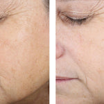 skinbetter science Even Tone Correcting Serum, results photo