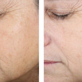 skinbetter science Even Tone Correcting Serum, results photo