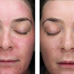 skinbetter science Sunbetter Tone Smart SPF 75 Lotion, results photo