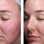 skinbetter science Sunbetter Tone Smart SPF 75 Lotion, results photo